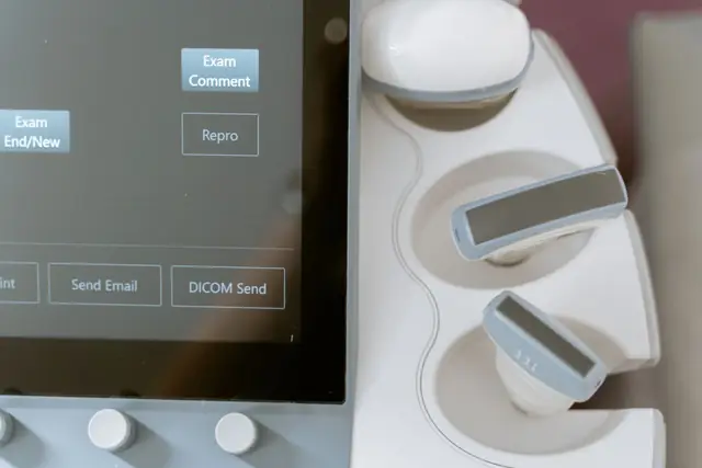 An ultrasound machine of the kind used for kidney and bladder scans